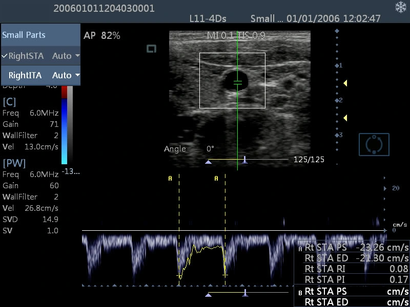 Am-5000 Full-Digital Color Doppler Ultrasound Diagnostic System Ultrasound Scanner