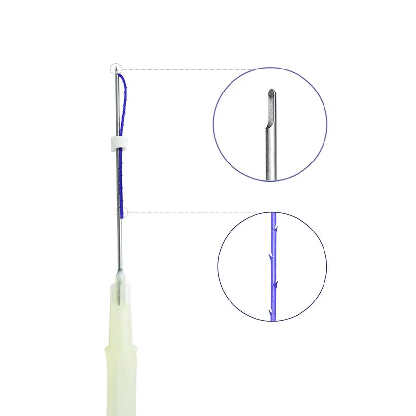 Subproceso de Magik Pdo de rosca de elevación 19g Cog 3-1 L cánula nasal sutura médicos Cara Cog la rosca con la aguja