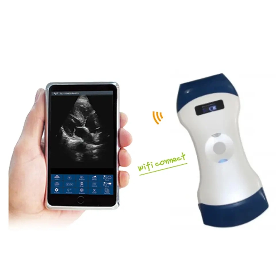 Double Head Color Doppler Portable Wireless Handheld Ultrasound Probe Scanner