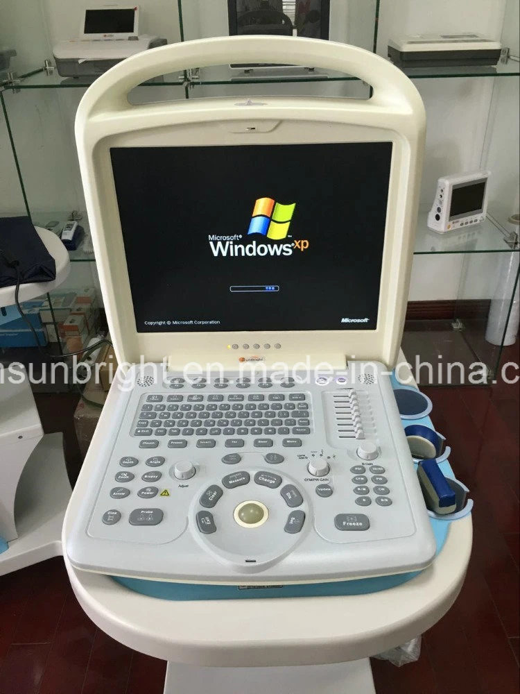 Portable Echo Color Doppler System 2D Ultrasound Machine