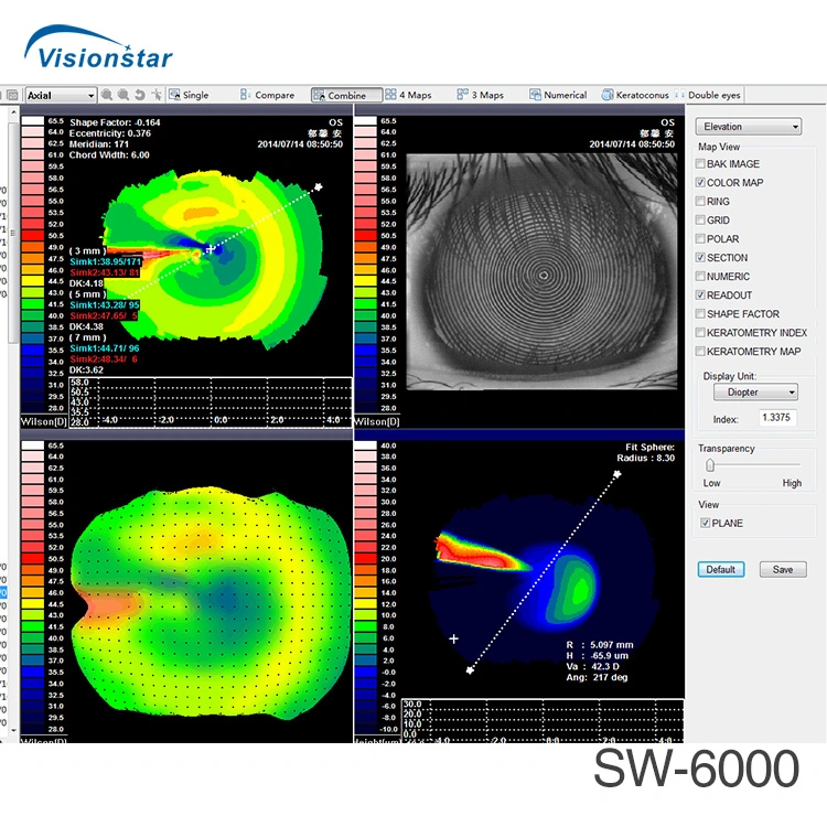 China Manufacture Sw-6000 Ophthalmic Corneal Topographer