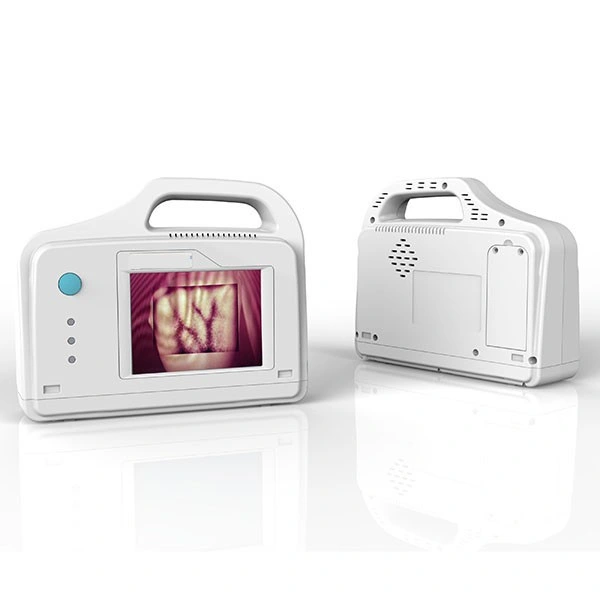 Infrared Portable Vein Locator Vein Detector