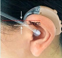 Same Touching Lotus Digital Severe Hearing Loss Hearing Aids