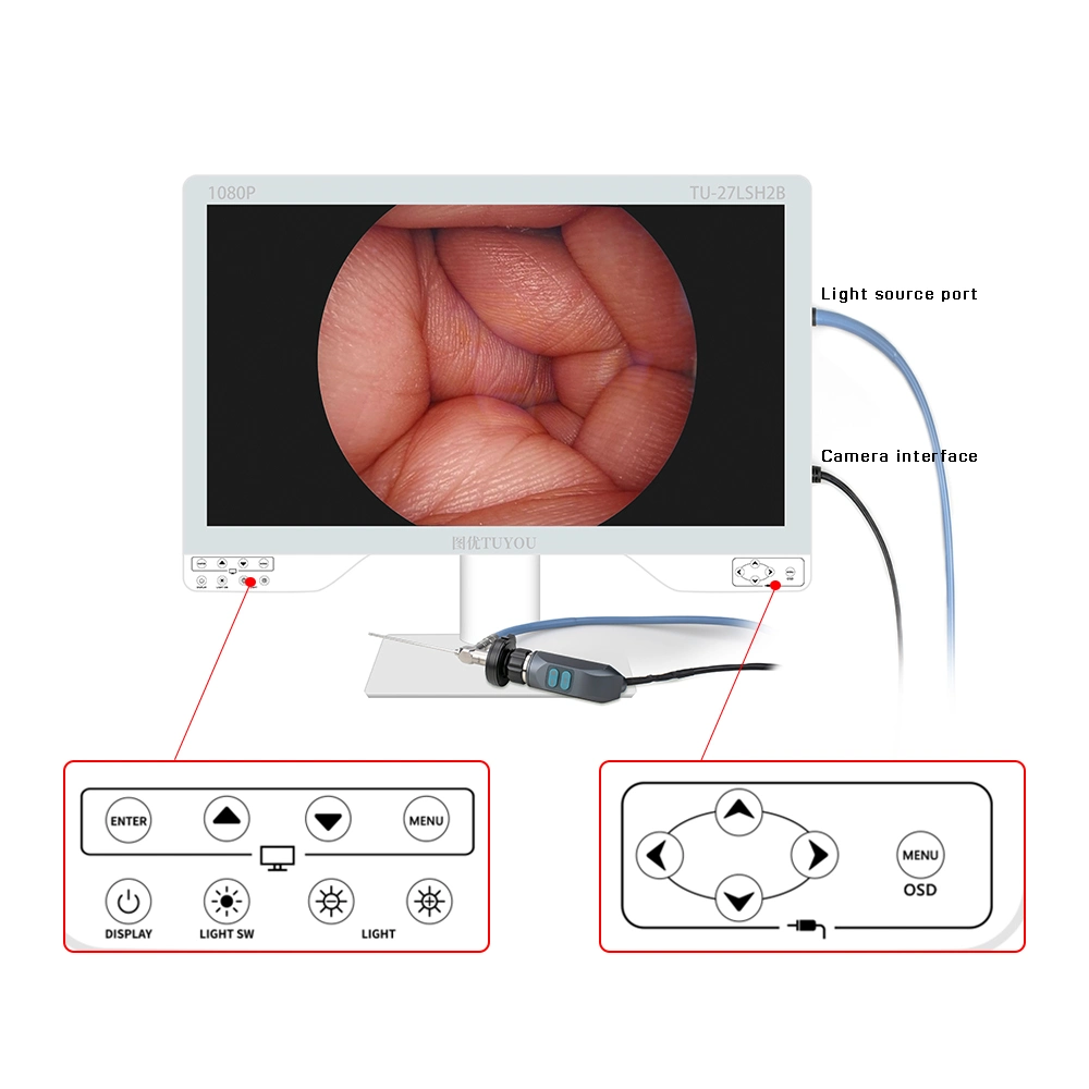 Equipamento de endoscopia Médica Tudvocê de valor elevado com endoscópio cirúrgico Câmara