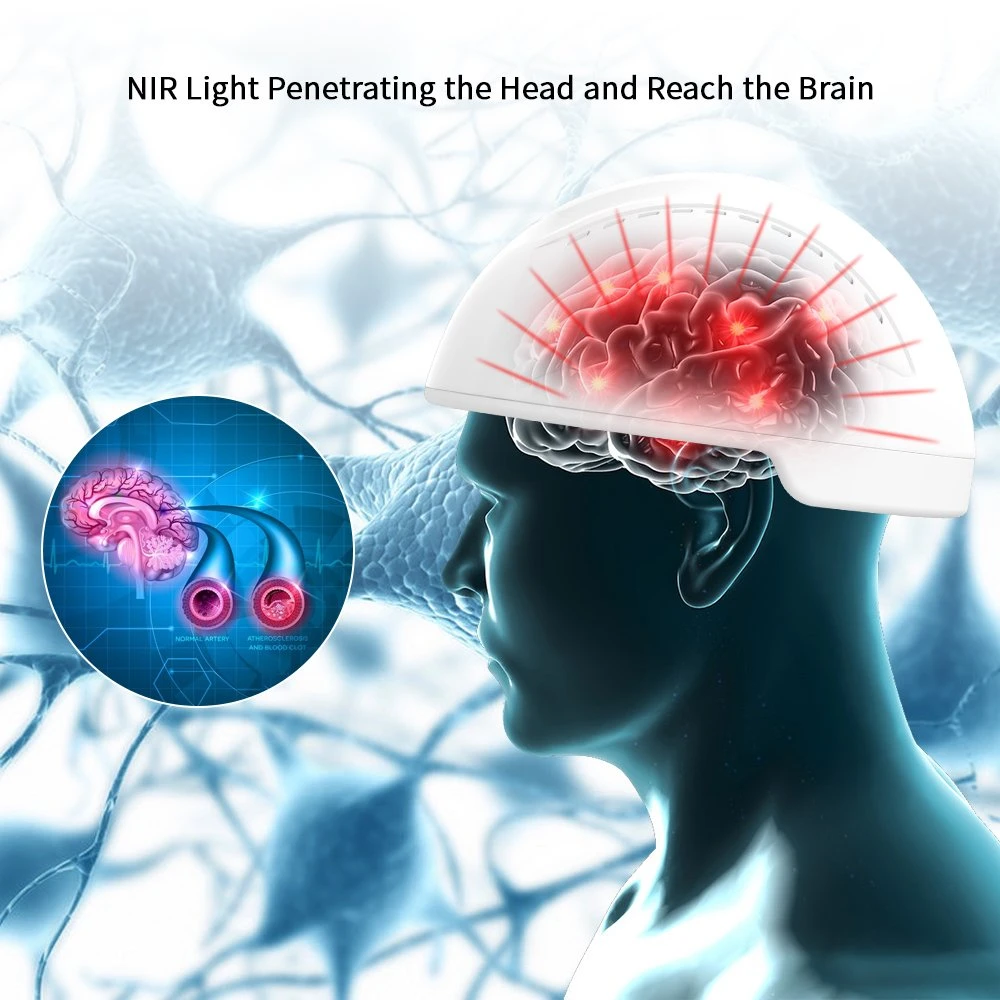 Curación de Parkinson Suyzeko Terapia de luz infrarroja estimulación del nervio cerebral Casco Para ancianos