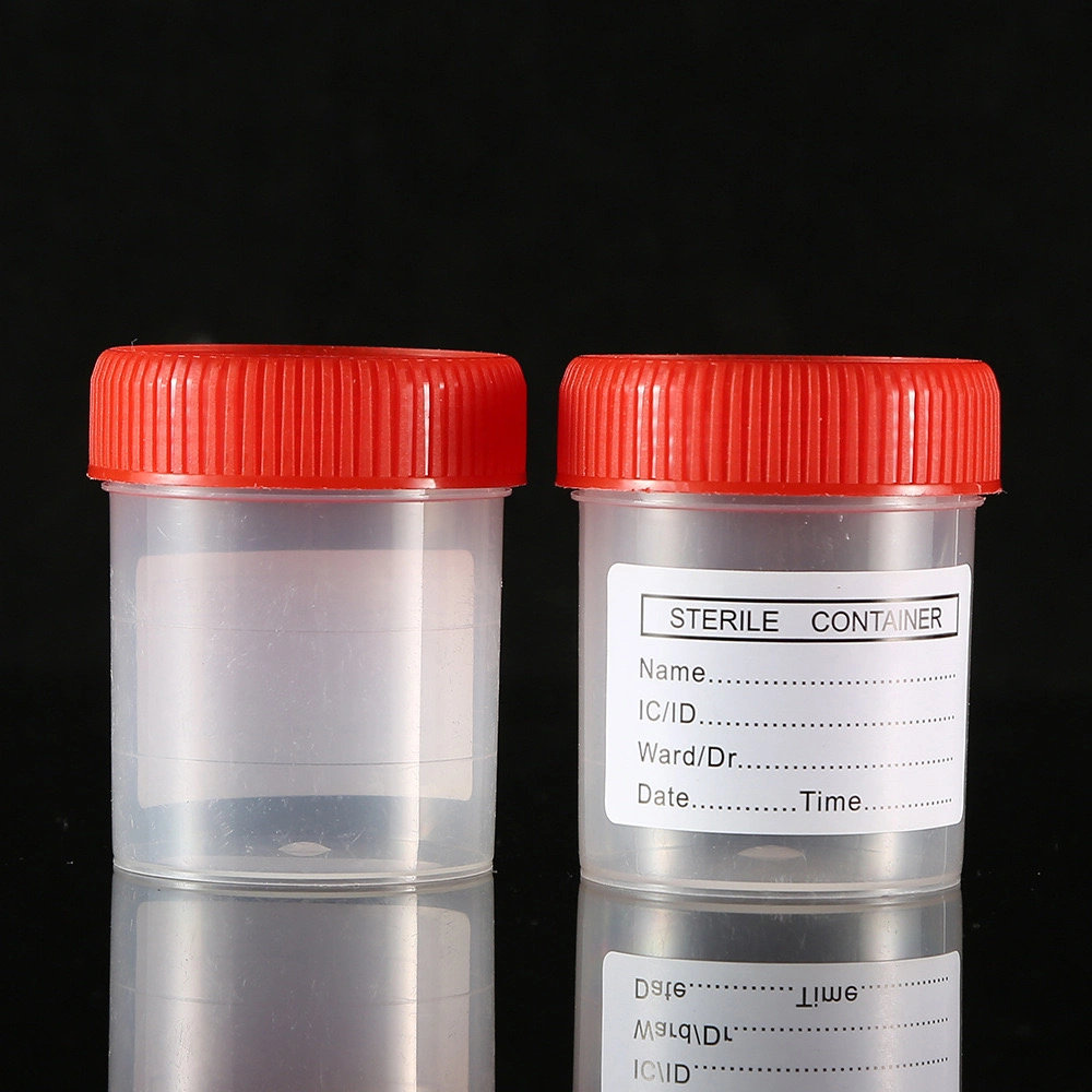 Disposable Laboratory Medical Test Sample Urine Container /Specimen Wholesale/Supplier