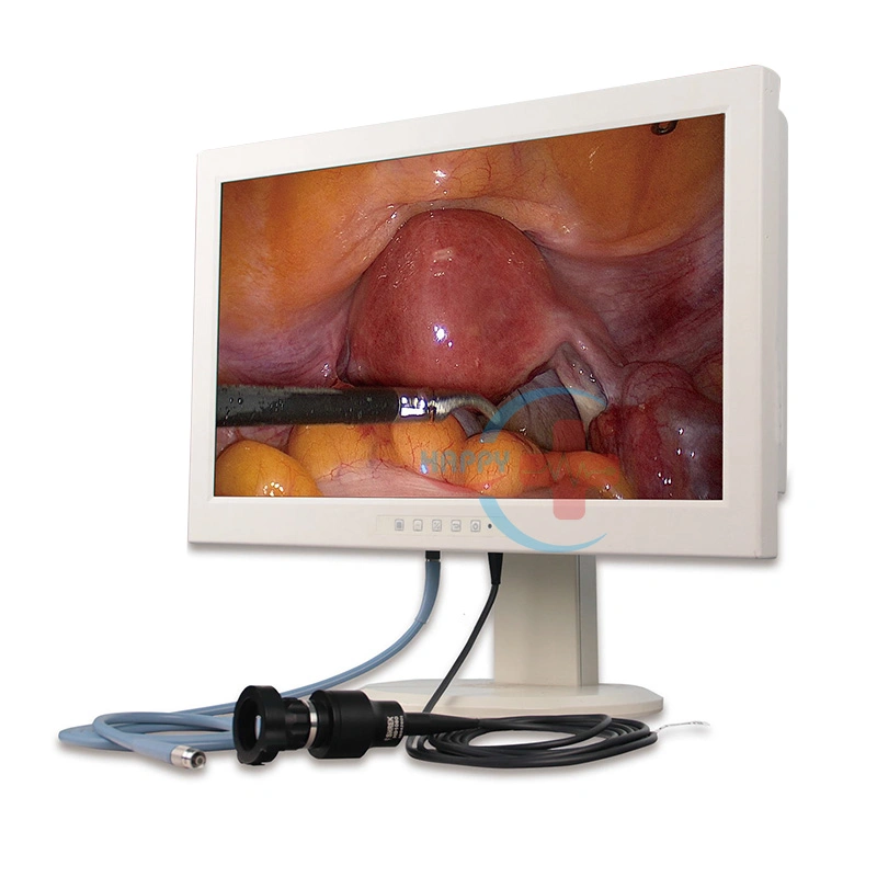 Hc-J040f professionnel HD à l'endoscopie médicale et chirurgicale des ent Endoscope Endoscope Portable Système de caméra