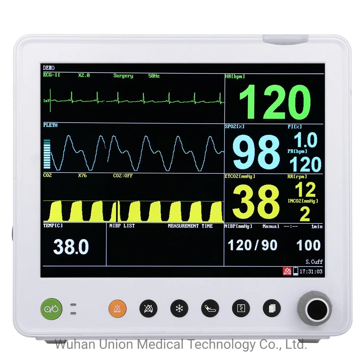 12 Inch Medical Patient Monitor with Anesthesia Gas