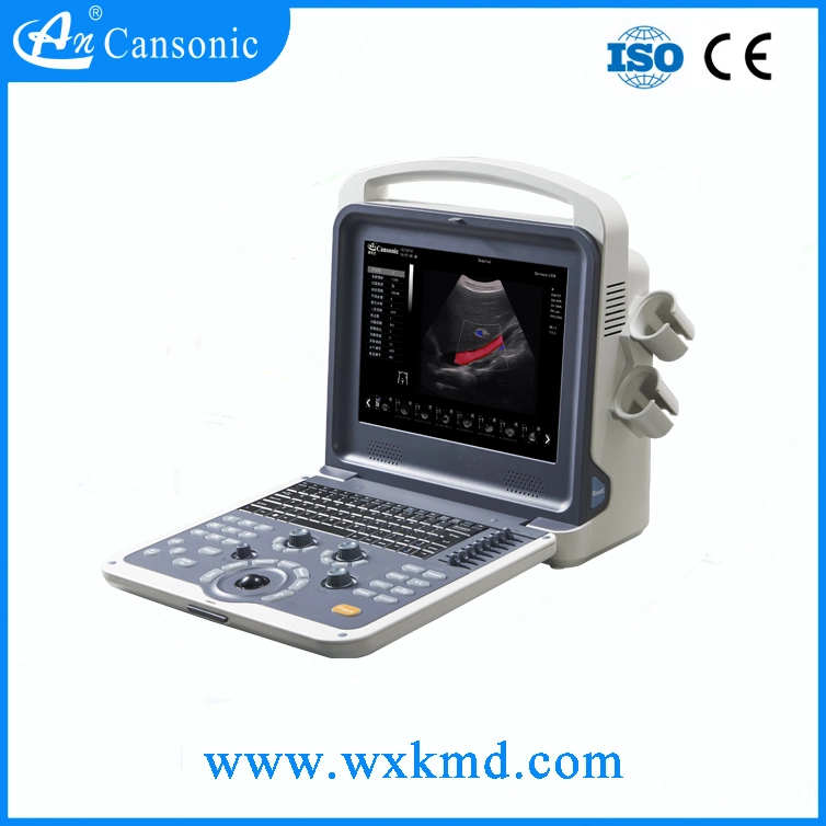 Portable 4D Ultrasound Scanner (K6)