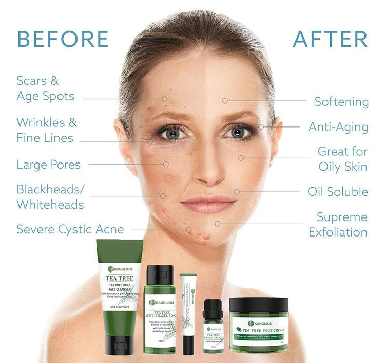 Tea Tree Skin Care Set for Healthy and Balanced Skin