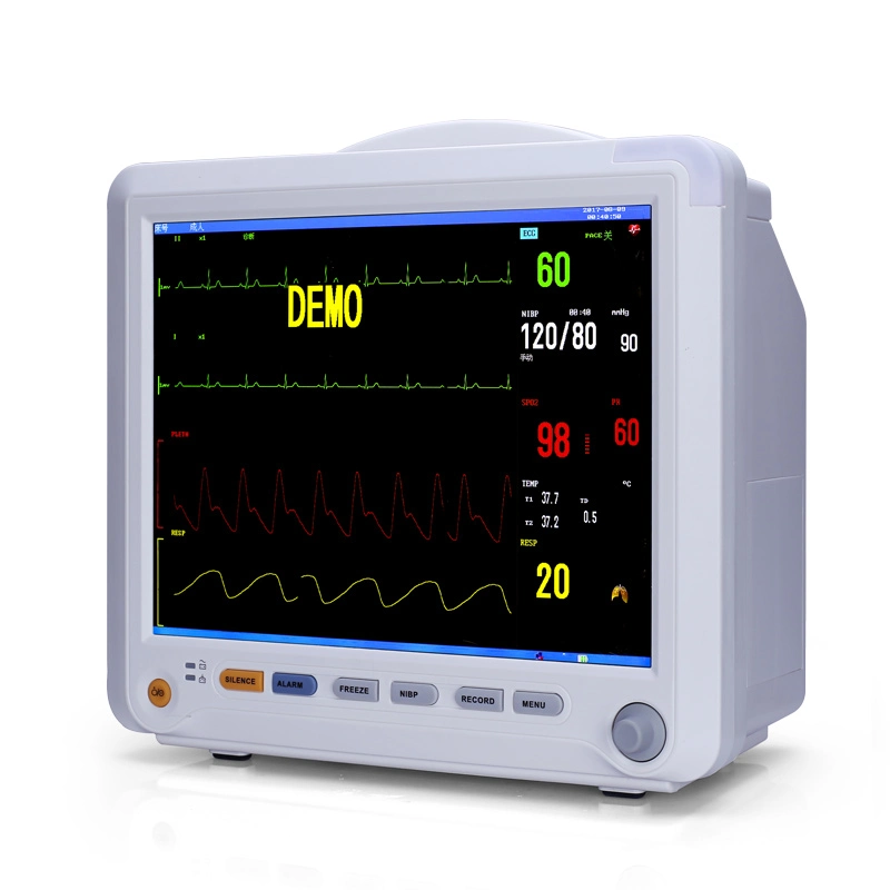 12TFT Screen Multiparameter Patient Monitor 6 Parameter Medical Equipment Inside Printer Cardiac Monitor or Hospital