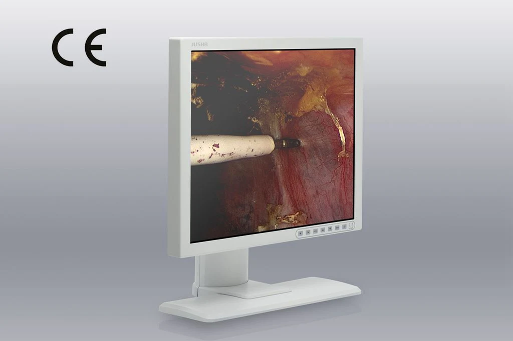 19-inch LCD 1280x1024 Pacs Monitor para el equipo de Hospital CE