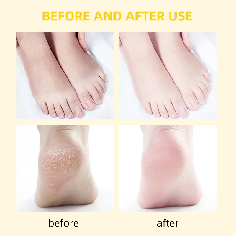 Peeling Exfoliating Foot Mask Remove Dead Skin Cuticles Heel Foot Care Private Label Foot Mask Socks