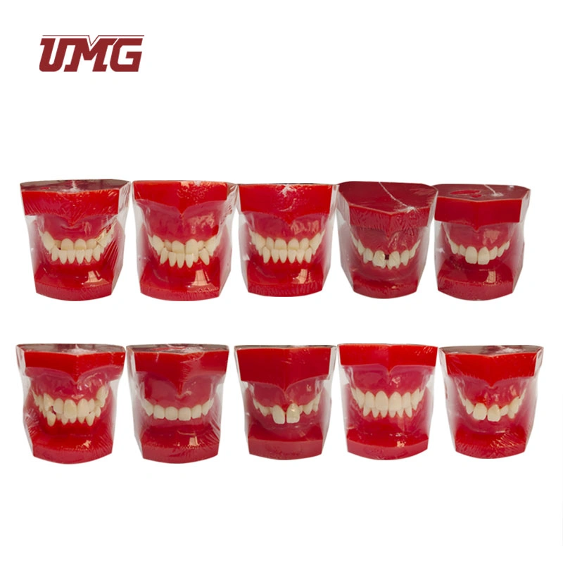 Enseignement dentaire modèle éducatif des dents humaines modèle de classification orthodontique (rouge)
