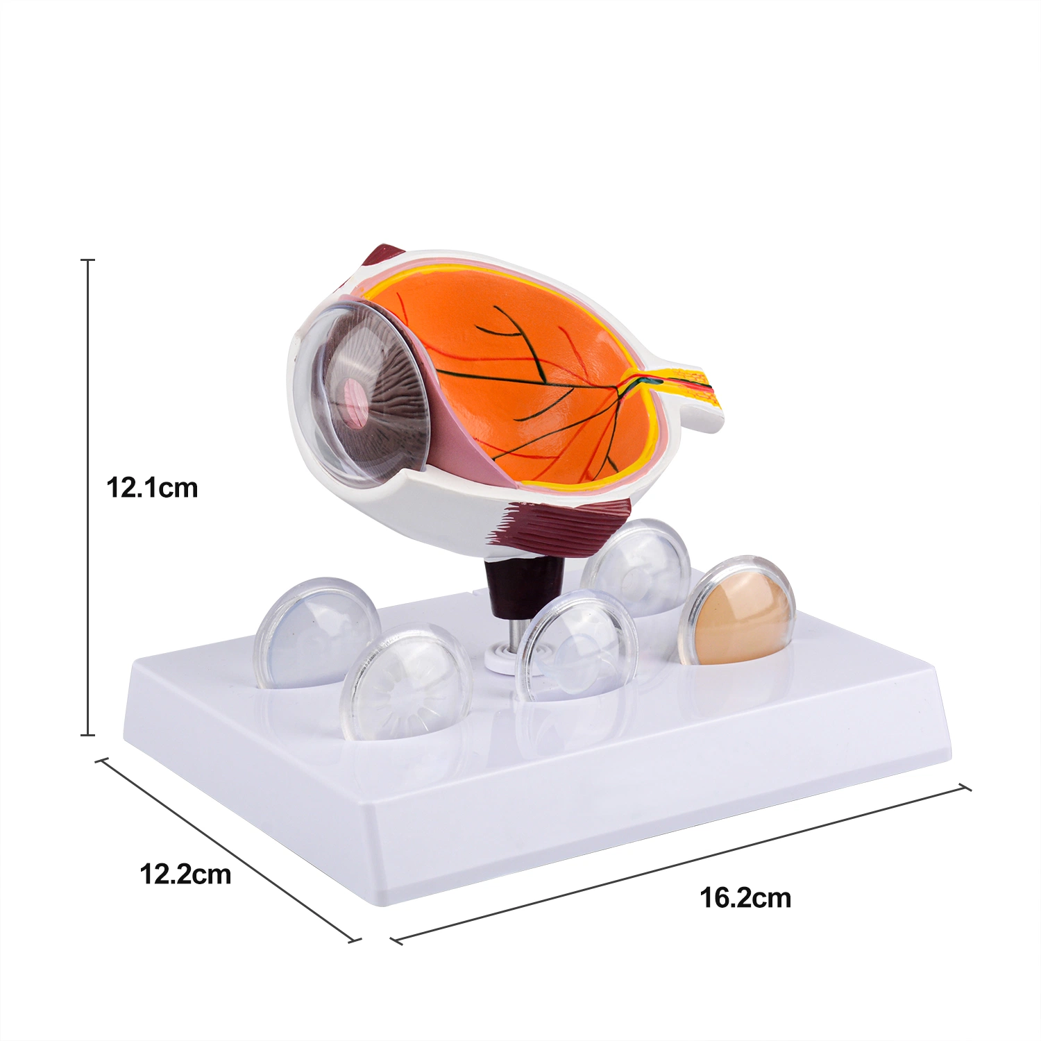 Human Cataract Eye Anatomical Model