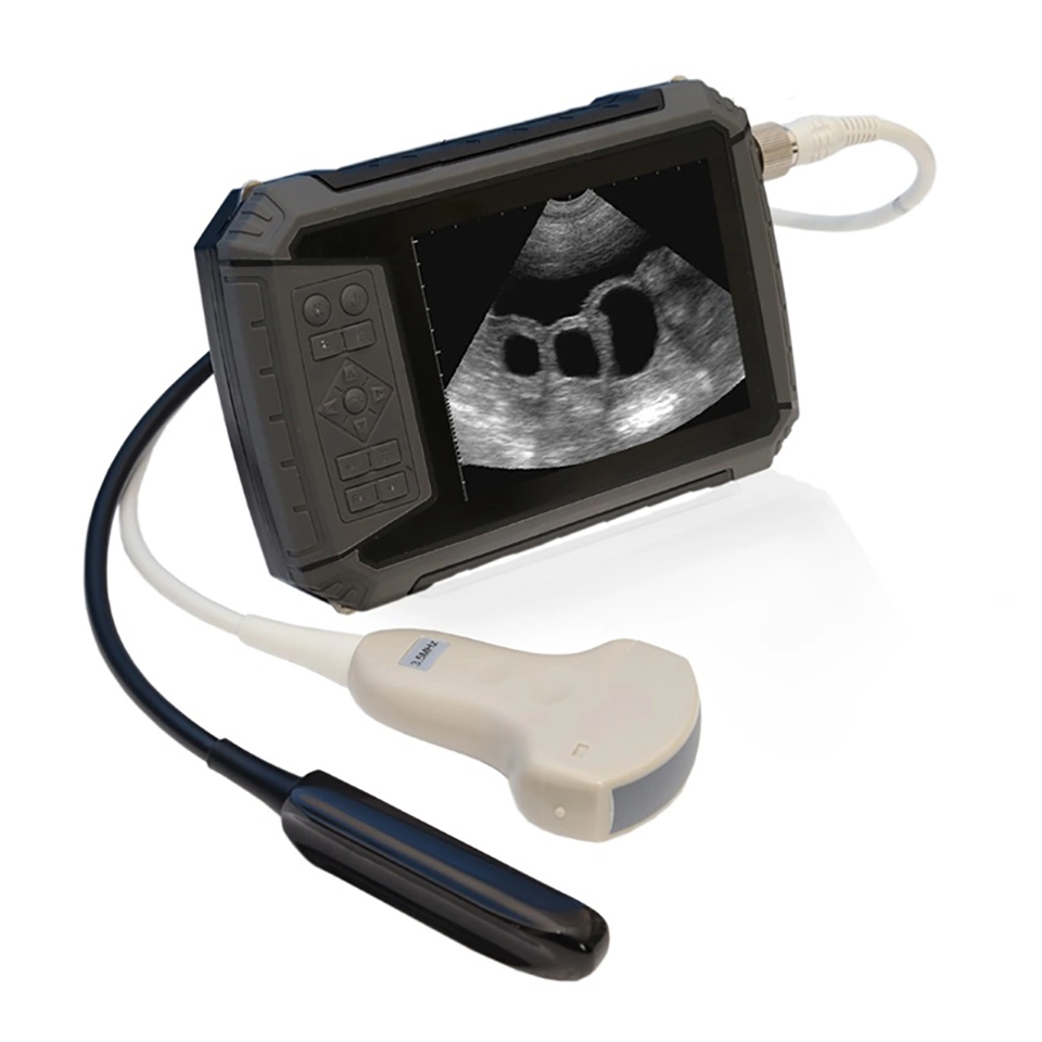 Handheld Ultrasound Wireless UL Mecanmed Sheep Medical Products Ecografos Veterinario in China