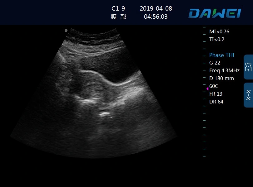 Trolley Black and White Ultrasound Scanner Dw-370 PC