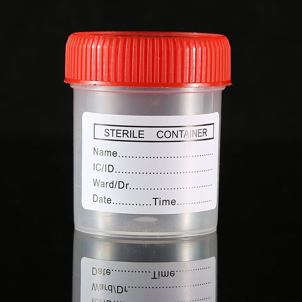 Disposable Laboratory Medical Test Sample Urine Container /Specimen Wholesale/Supplier