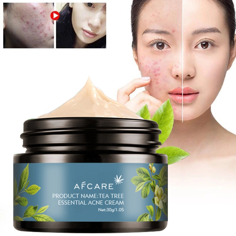 Venda por grosso ODM OEM Anti Acne Embranquecimento Anti Envelhecimento Anti rugas Pele Avivamento Embranquecimento Pulverizar Aloe Creme Facial Creme Facial Taiwan Creme Facial Tumeric