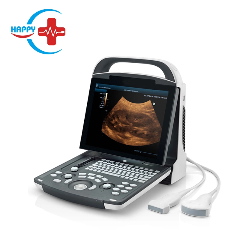 Dp-10 Hospital Medical Equipment Ultrasound Machine Scanner Mindray Portable Full Digital Ultrasound with LED Display