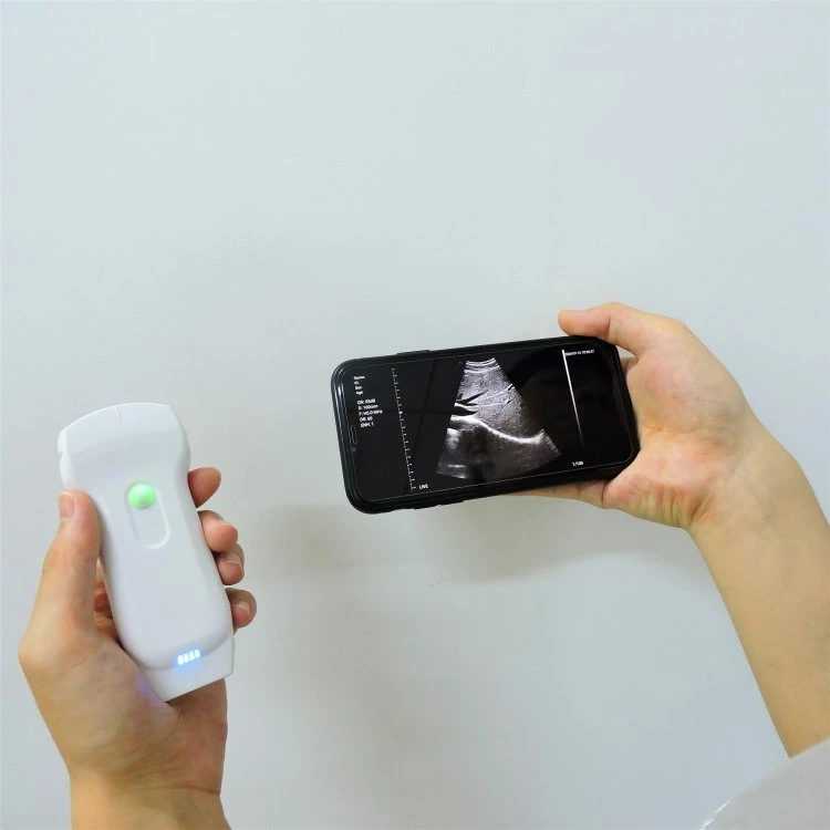 Медицинские устройства Низкая цена смартфона USB WiFi портативный Echographe беременности цветного доплеровского ультразвукового сканера