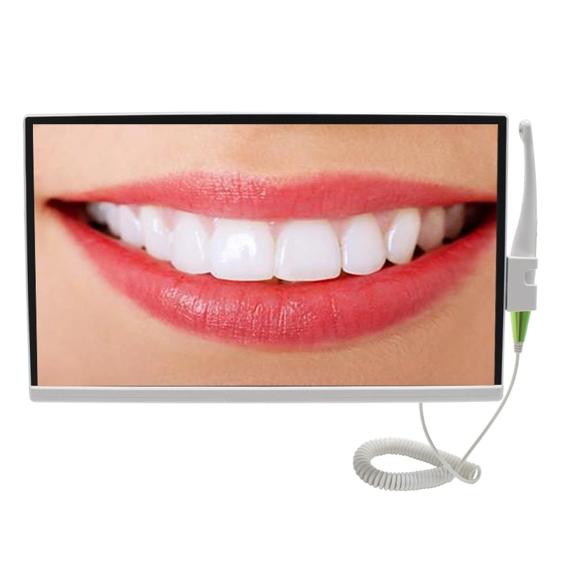 Dental Computer Встроенная эндоскопическая HD камера AI Image System