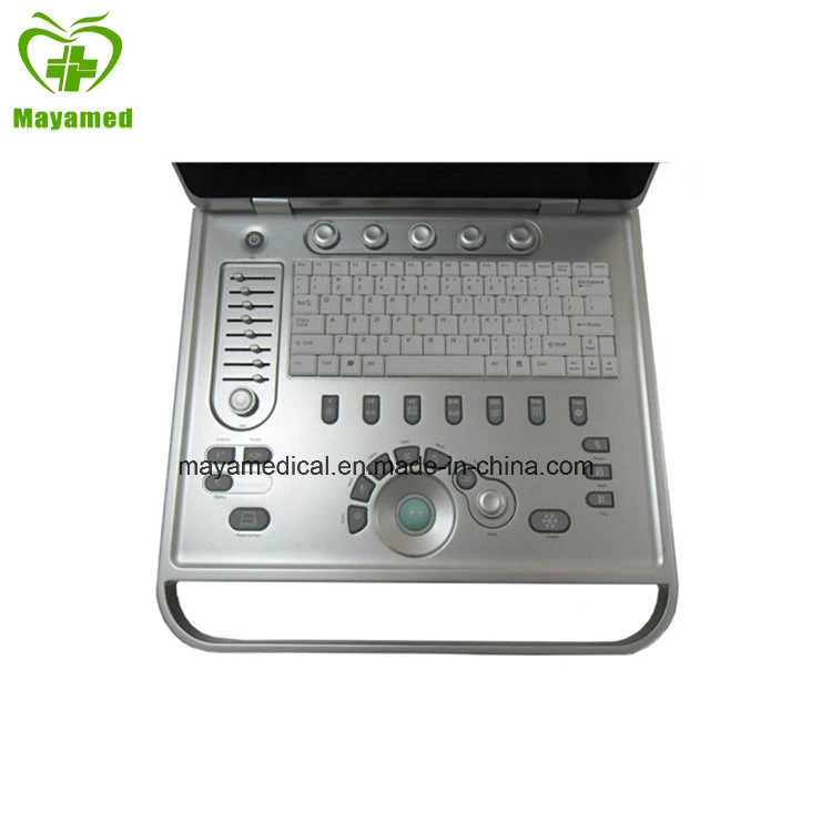 My-A009 15inch Screen PC Based Laptop Ultrasound B Scanner