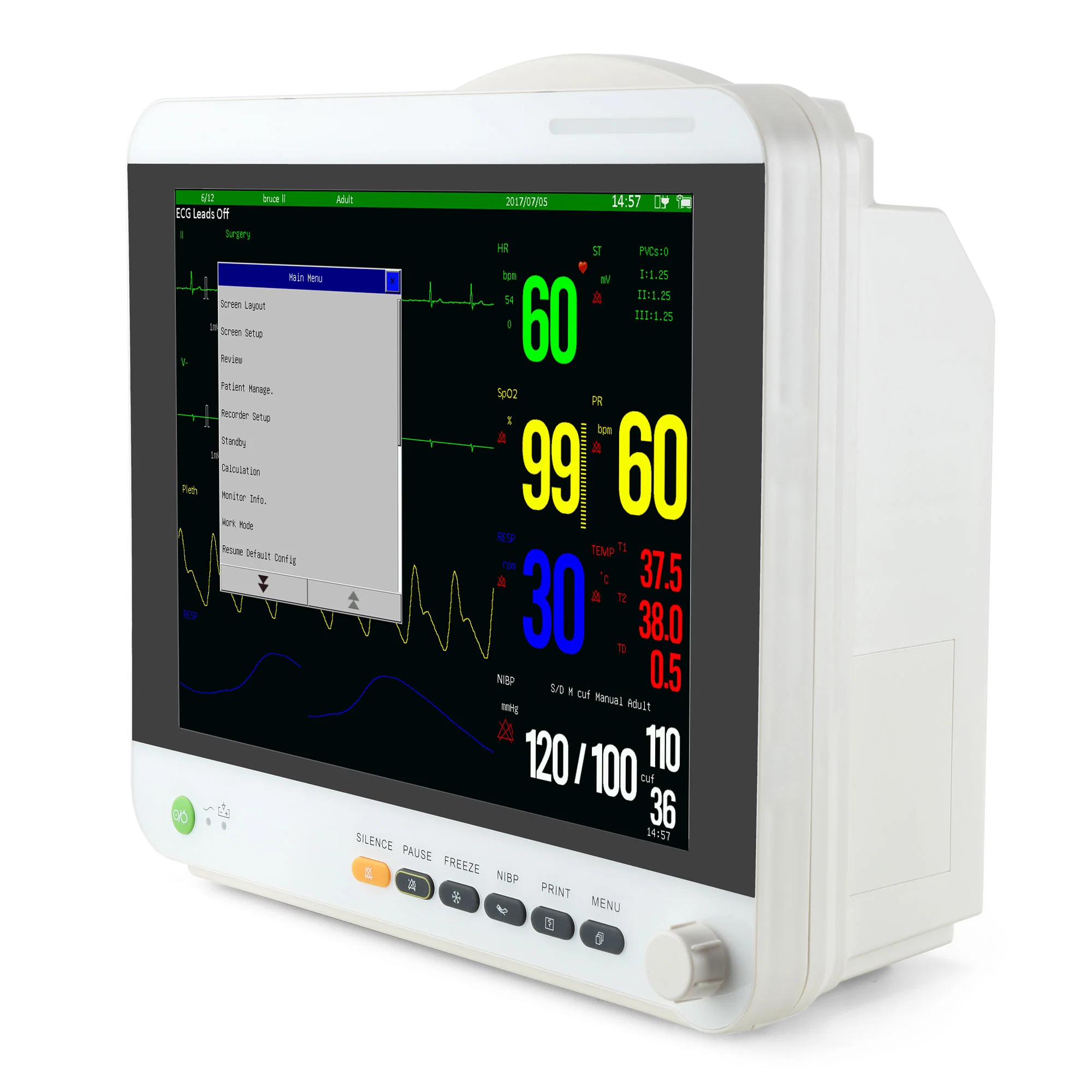 Sinnor 15inch Standard 6parameter Patient Monitor with Full Accessories for Adult Peadiatrict Neonatal and Veterinary Use Snp9000ia Factory Supply