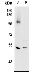 Cathepsin C Hc Pab