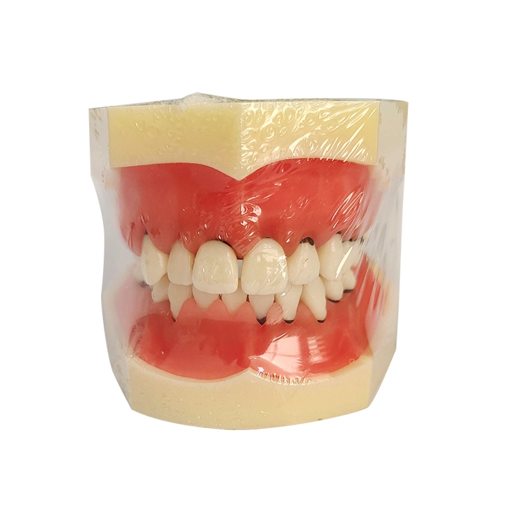 Dental Study Model Periodontal Model