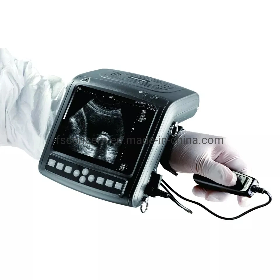 Medical Ccv-U5200 Rectal Probe Veterinary Palm Wrist Ultrasound Scanner Equipment