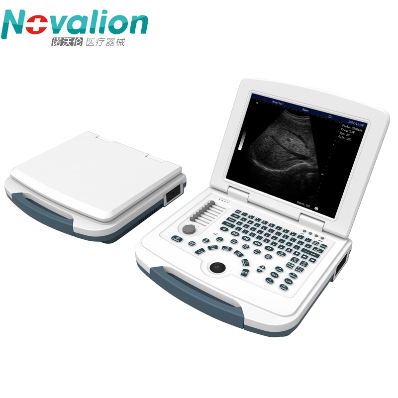 Fast Delivery Portable Digital Black and White B/W Ultrasound Scanner