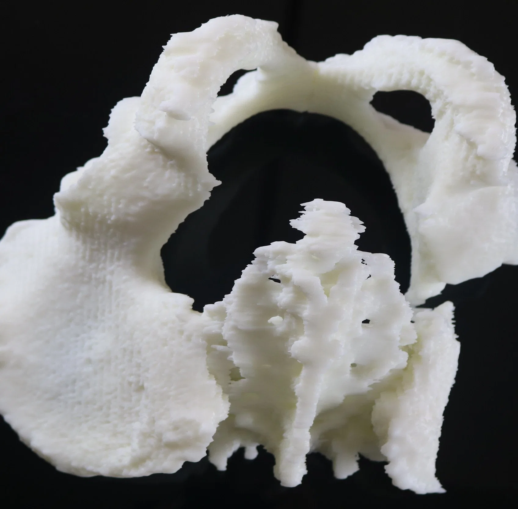 High Quality SLA Resin 3D Printing Service for Zygomatic Model