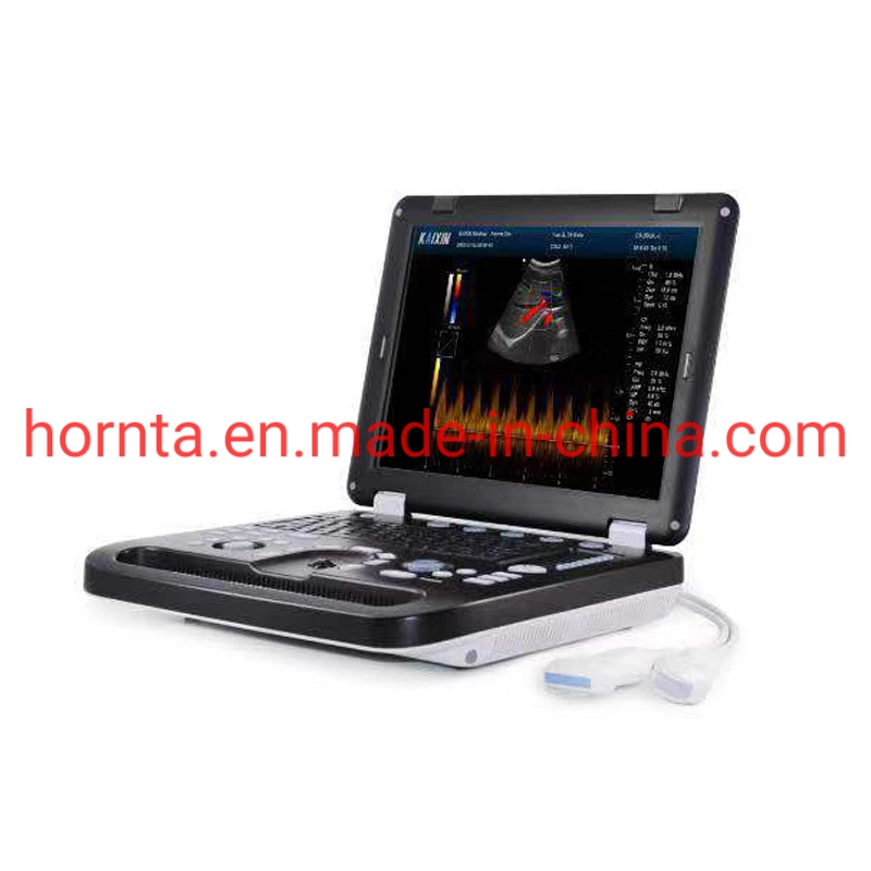 Dcu50 Color Doppler B-Ultrasound for Pig Cattle Horse Camel