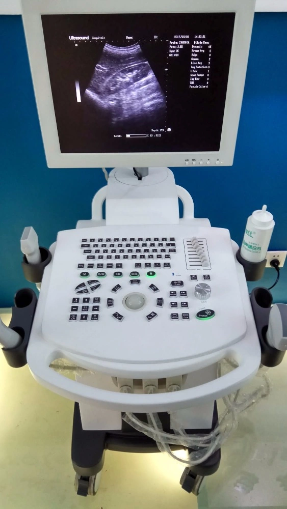 Hospital Diagnostic Equipment Trolley Full Digital Ultrasound Machine (THR-US370)