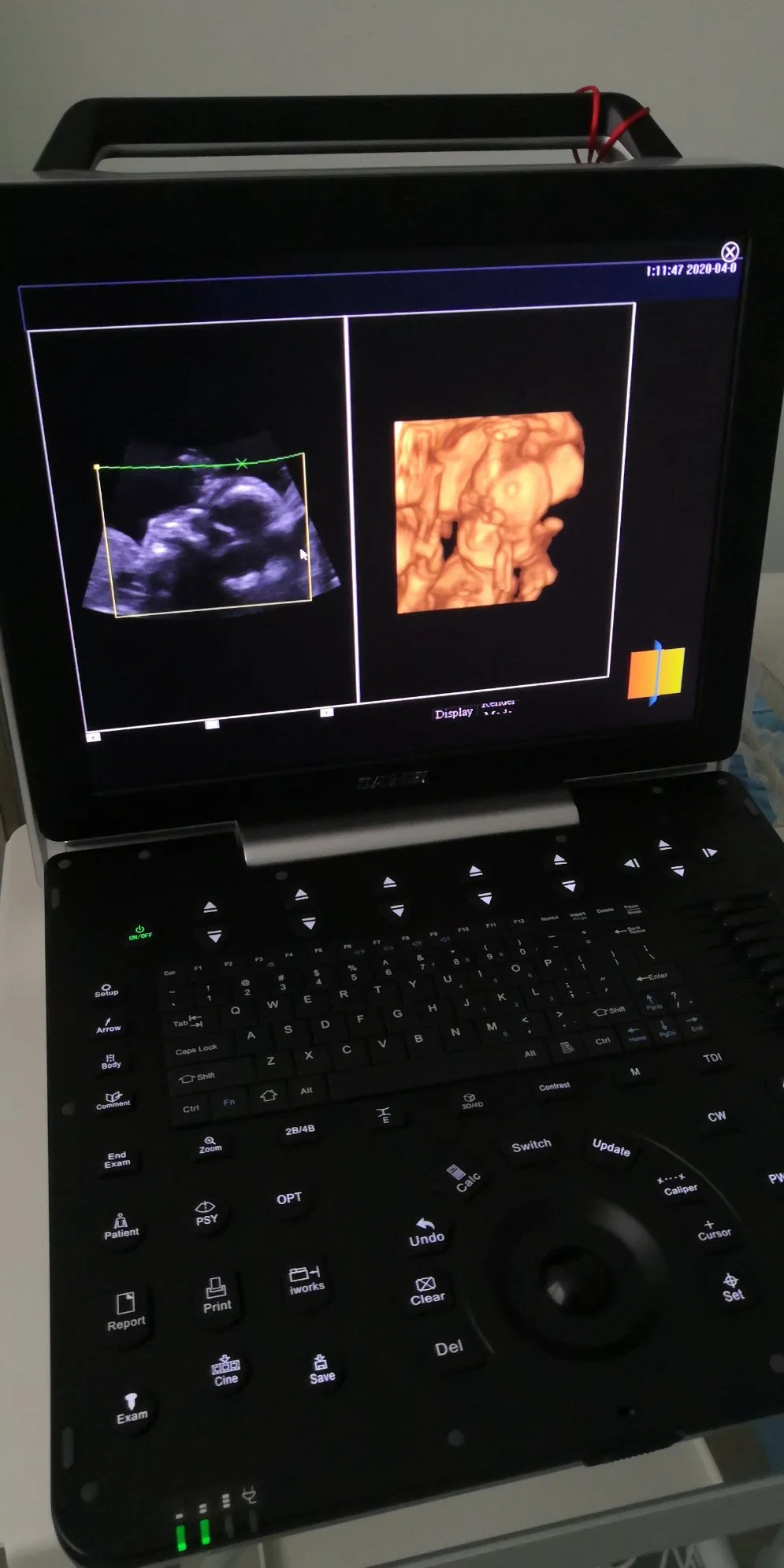 DW-P8 Echocardiography Heart Ultrasound General pw CW Thi M-Mode