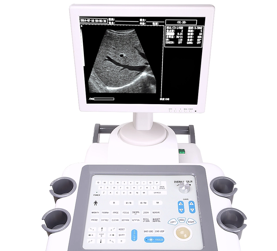 Hochey Medical Ultrasound Pets Portable Animals Vet B Scanner LED Veterinary Ultrasound