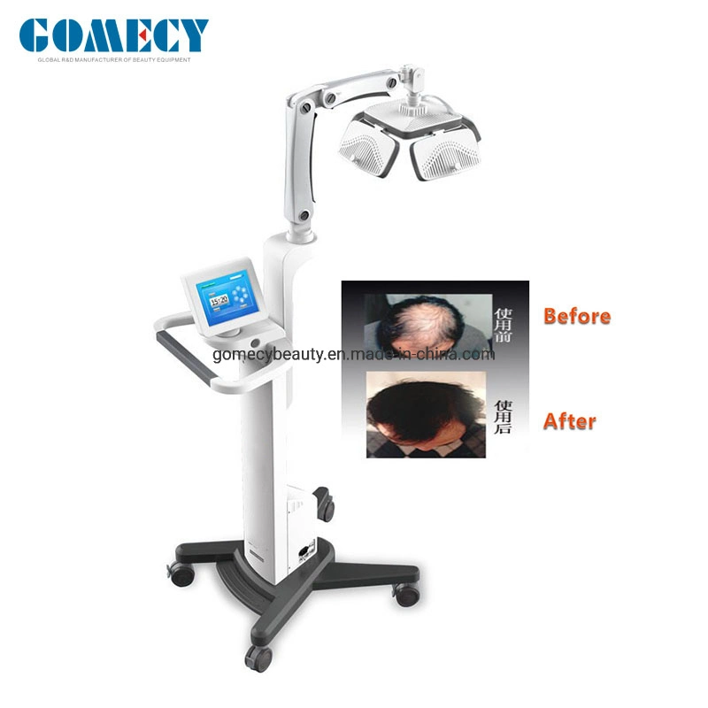 650nm Laser Semiconductor Cold Laser Beauty Equipment Laser Hair Loss Treatment