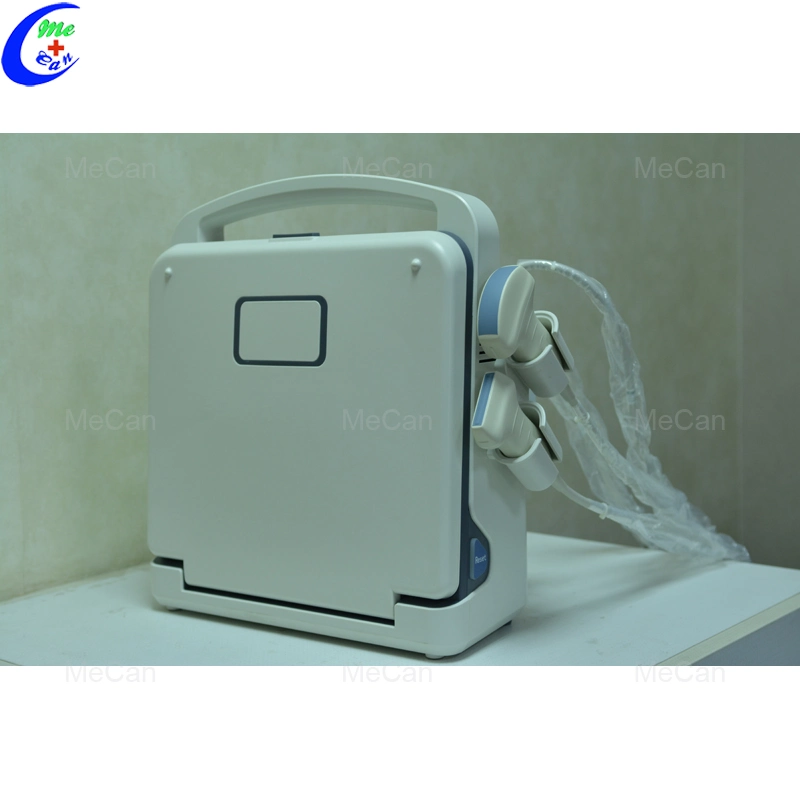 Full Digital Color Doppler Ultrasound Diagnostic System Portable Ultrasound