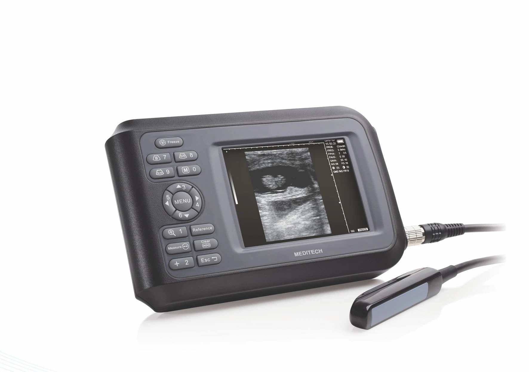 Portable Plam Ultrasound Scanner with CE Certificate Family Doctor Clinical