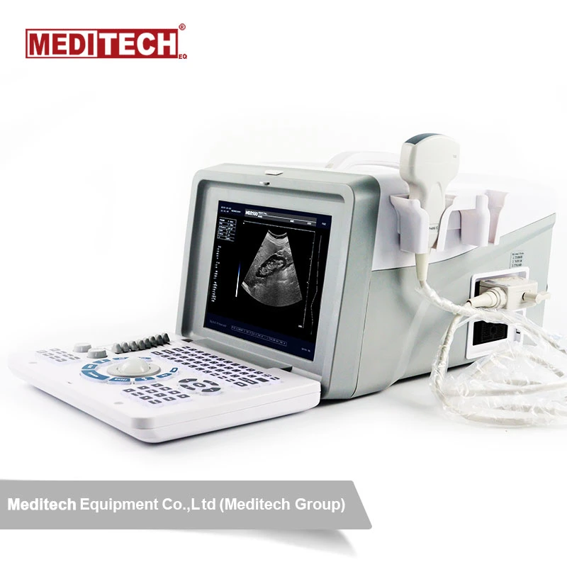 Ultrasound Scanner Laptop CE and ISO Approved for Pregnancy