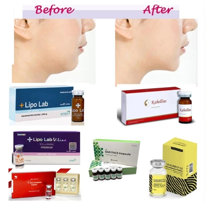 Korea Lipo Lab Lipolitic Liposis Solution 10ml PPC Solution Kabelline Disolución de grasa para pérdida de peso Inyección de adelgazamiento Mesoterapia Kybella