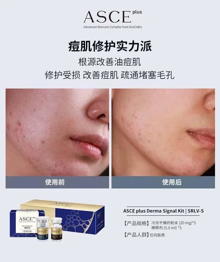 Cytocare 715 + Asce Plus Derma Signal Kit Srlv-S Human Stem Exsome, Best Effect for Skin Firming, Lifting, Anti-Aging, Results Are Immediately Visible