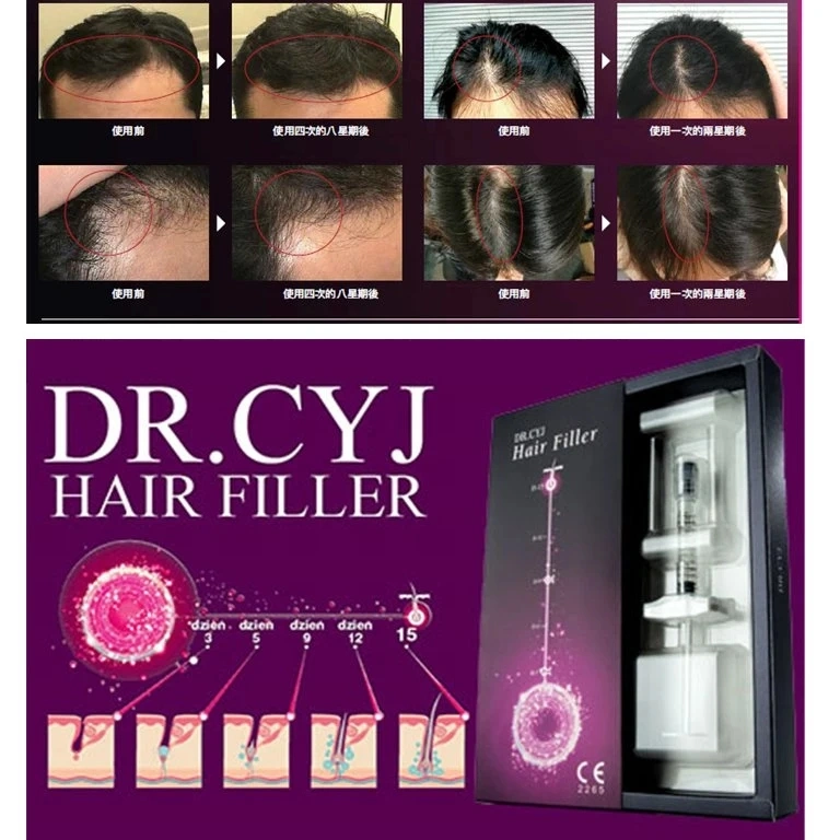 The World′ S First Hair Filler Dr. Cyj Hair Filler resultados precios Reseñas Peptide tratamiento de problemas de Cabello Terapia de pérdida de Cabello caída de Cabello mejorar el grosor