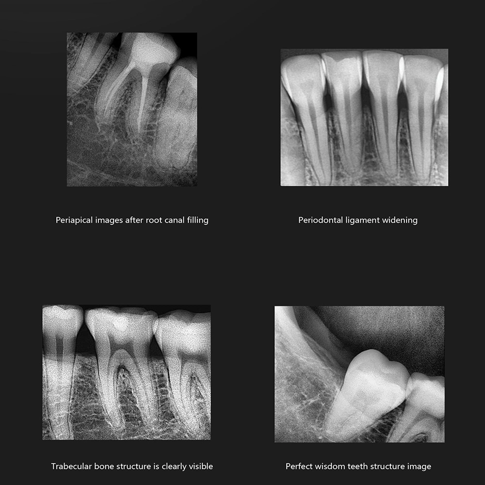 Good Price Dental Intraoral Sensor, Rvg X Ray Imaging Sensor