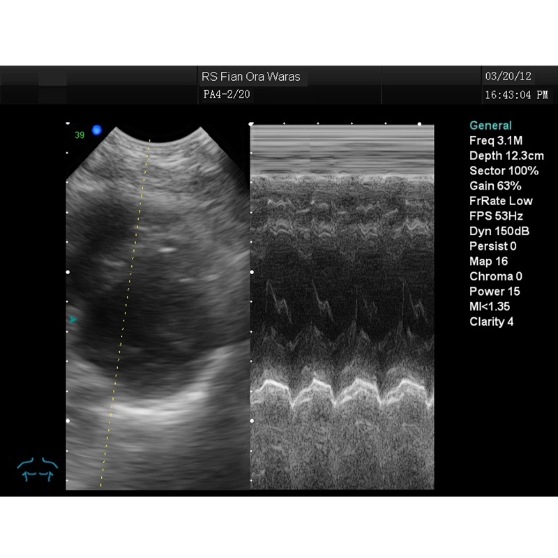 My-A027 3D Full Digital Color Doppler Ultrasound