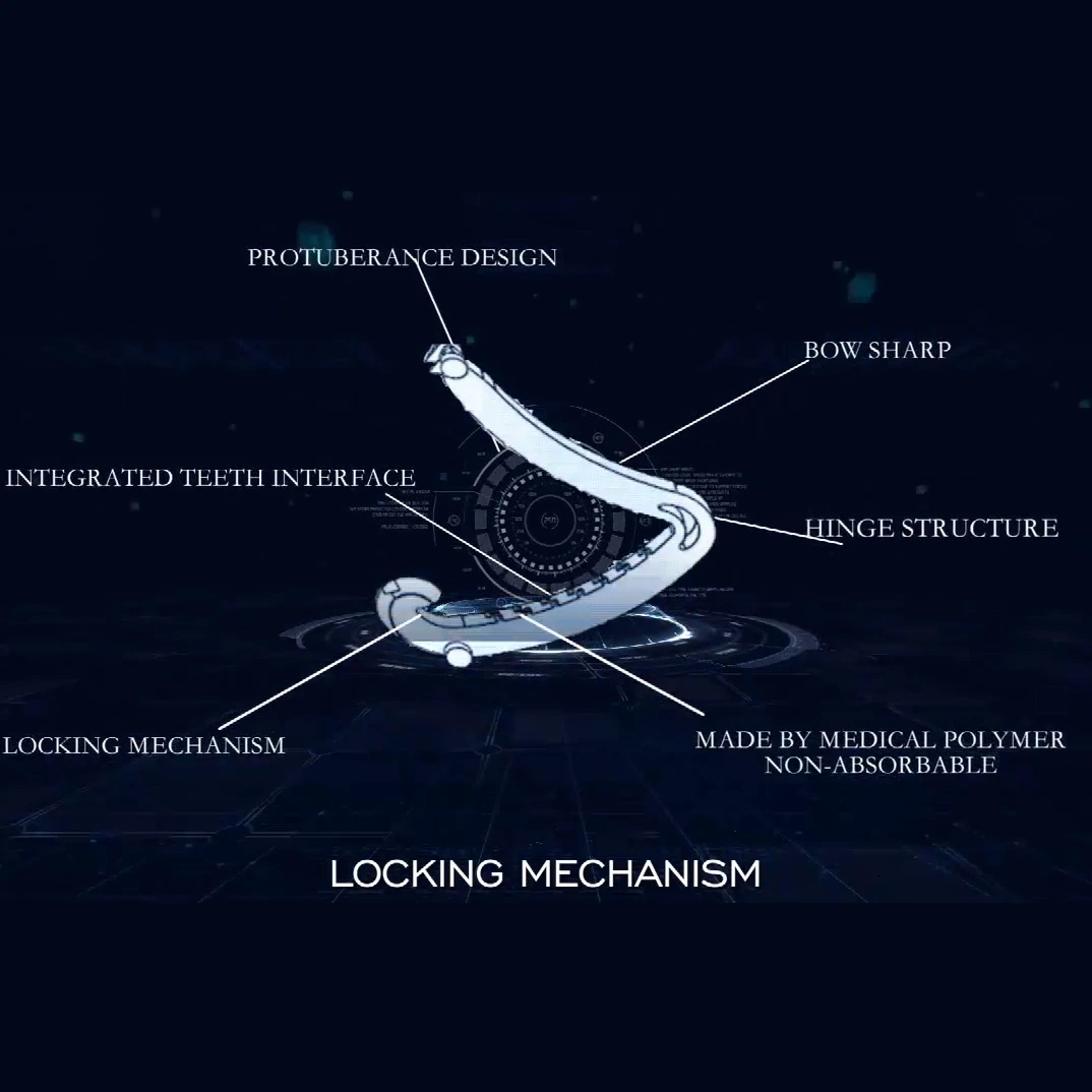 Hochwertige laparoskopische einmal Endoskopie Clips Ligatur Clips angewendet Harnchirurgie