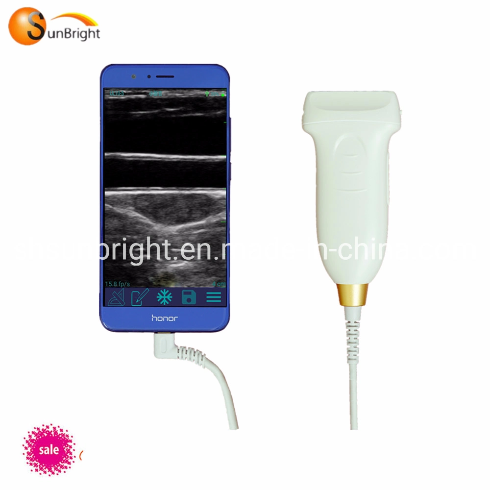 Cheap Price Digital Handheld USB Convex/Linear Ultrasound Probe for Laptop