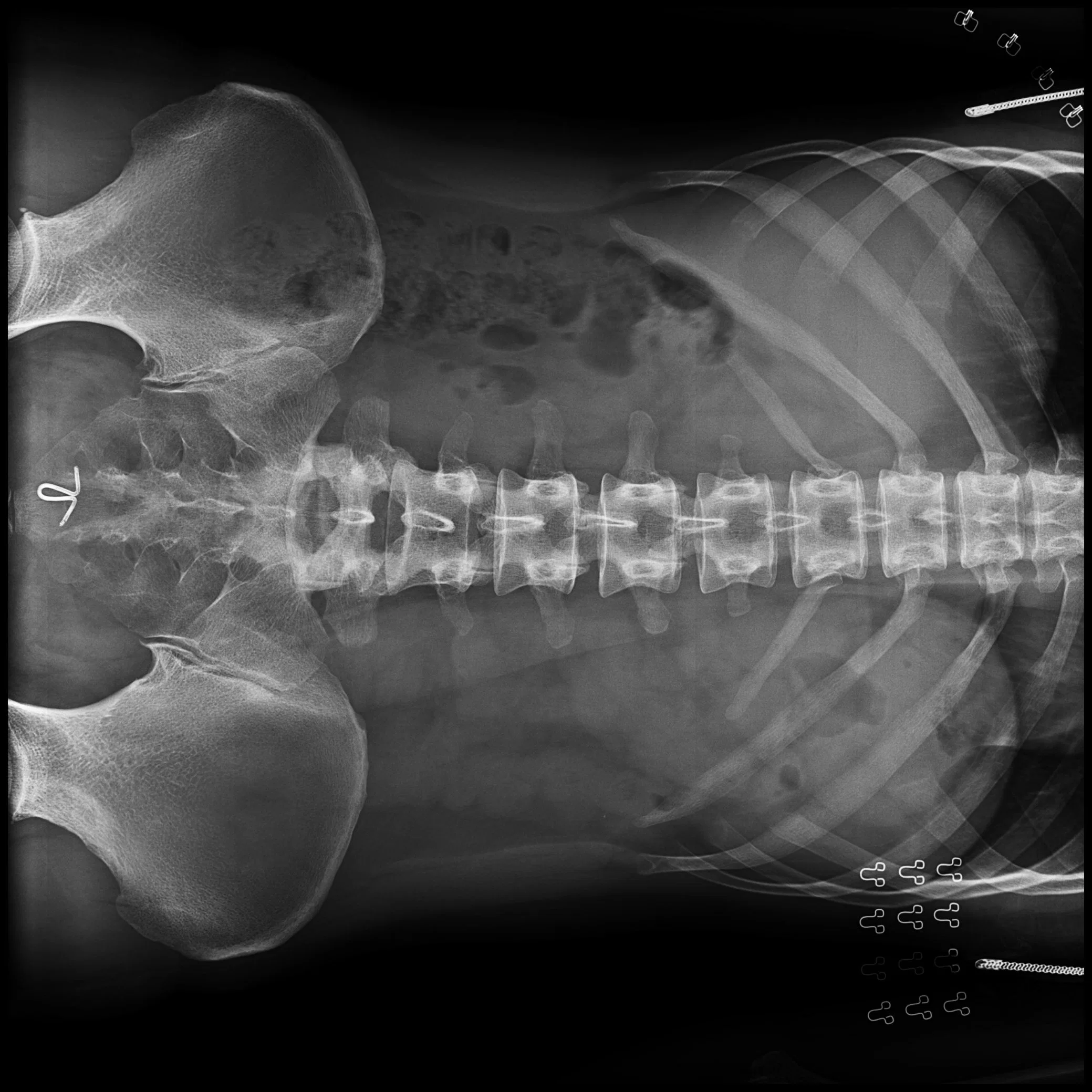 My-D056A medizinische x-Strahl-Zubehör-Digital-drahtlose Flachbildschirm-Detektor Kassette-Größe für Dr. Röntgenmaschine