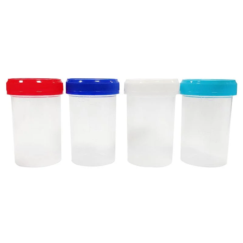 Factory Direct Hot Sale Disposable Sterile Specimen Plastic Urine Sample Cup 60ml Urine Containers Plastic Mould